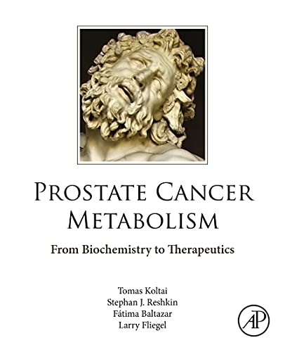 Prostate Cancer Metabolism: From Biochemistry to Therapeutics (English Edition)