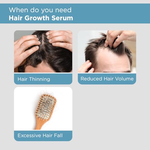 Image of The Man Company Hair Growth Serum for Man (30ml) with 3% Redensyl, 4% Anagain, 3% Biacapil | Stimulates Hair Growth | Prevents Hair Fall | Improves Hair Strength