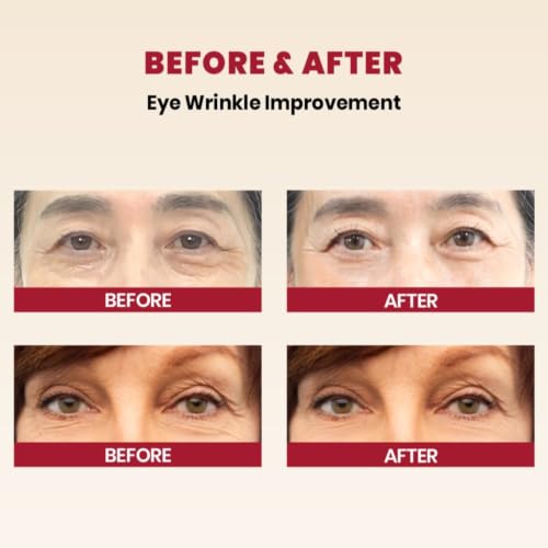 K-SECRET SEOUL 1988 Retinal Augencreme | Anti-Aging face cream mit 4% Retinal-Liposomen | Niacinamid, Bakuchiol, fermentierte Bohnen | Koreanische Hautpflege, 30 ml / 1,01 fl oz