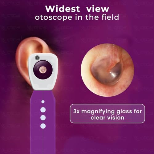 Image of OTICA 3.7V Professional Diagnostic Pocket LED Otoscope | Rechargeable In-Built 3500mAh Battery | Type-C Charging | Adjustable Intensity | 10 Disposable Specula + Spare Glass | 11707 - Purple