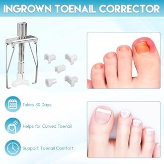 Ingrown Toenail Tools Kit