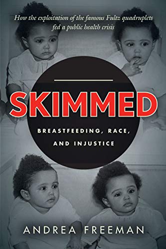 Skimmed: Breastfeeding, Race, and Injustice (English Edition) Livre eBook France