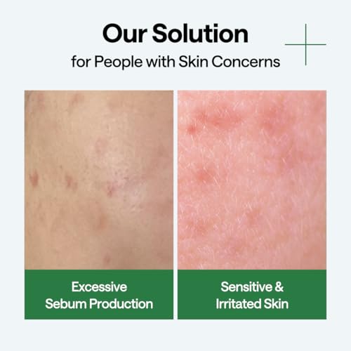 Image of MEDIHEAL Wrapping Serum Mask [Teatree] Calming Hydra - 99% Pure Teatree & Terpineol for Acne-Prone Skin - Helps Calm Redness & Control Excess Oil - Improves Overall Skin Clarity (10 Sheets)