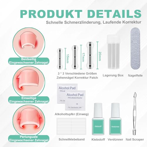 Eingewachsene Zehennägel Set Zehennagel Korrektur Patch 9pcs Nagelspange Fußnägel Zehennagelheber Werkzeugset für Paronychie Zehennagel Eingewachsen Reparatur, 0.59/0.67/0.79in