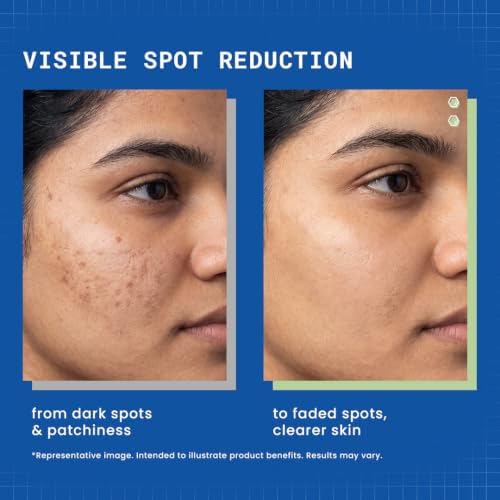 Image of DERMDOC 10% Vitamin C Brightening Face Serum - 30ml | With 0.4% Glutathione Complex Arbutin & Peptides | Reduces Dark Spot & Pigmentation | For Brighter, Even-Toned Skin | Hydrating Face Serum | All Skin Types