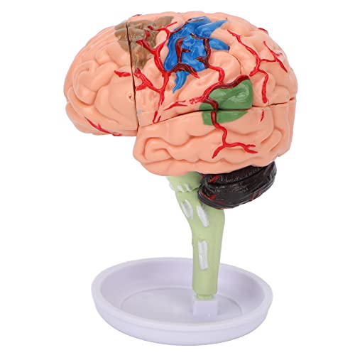 Modelo de cerebro anatómico 4D interactivo con estructura transparente de vinilo 5