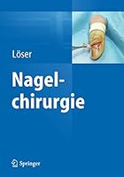 Nagelchirurgie 3642351867 Book Cover