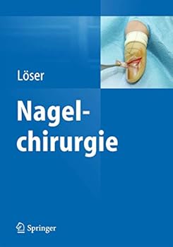 Hardcover Nagelchirurgie [German] Book