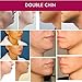 Neck, Chin & Jawline Sculpting V Line Chin Facial Mask and - Face Sagging Skin Garment Strap Bandage. Anacis