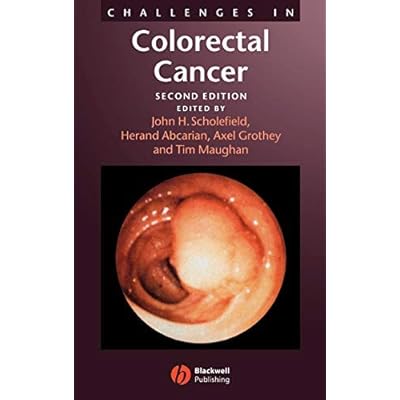 Challenges in Colorectal Cancer