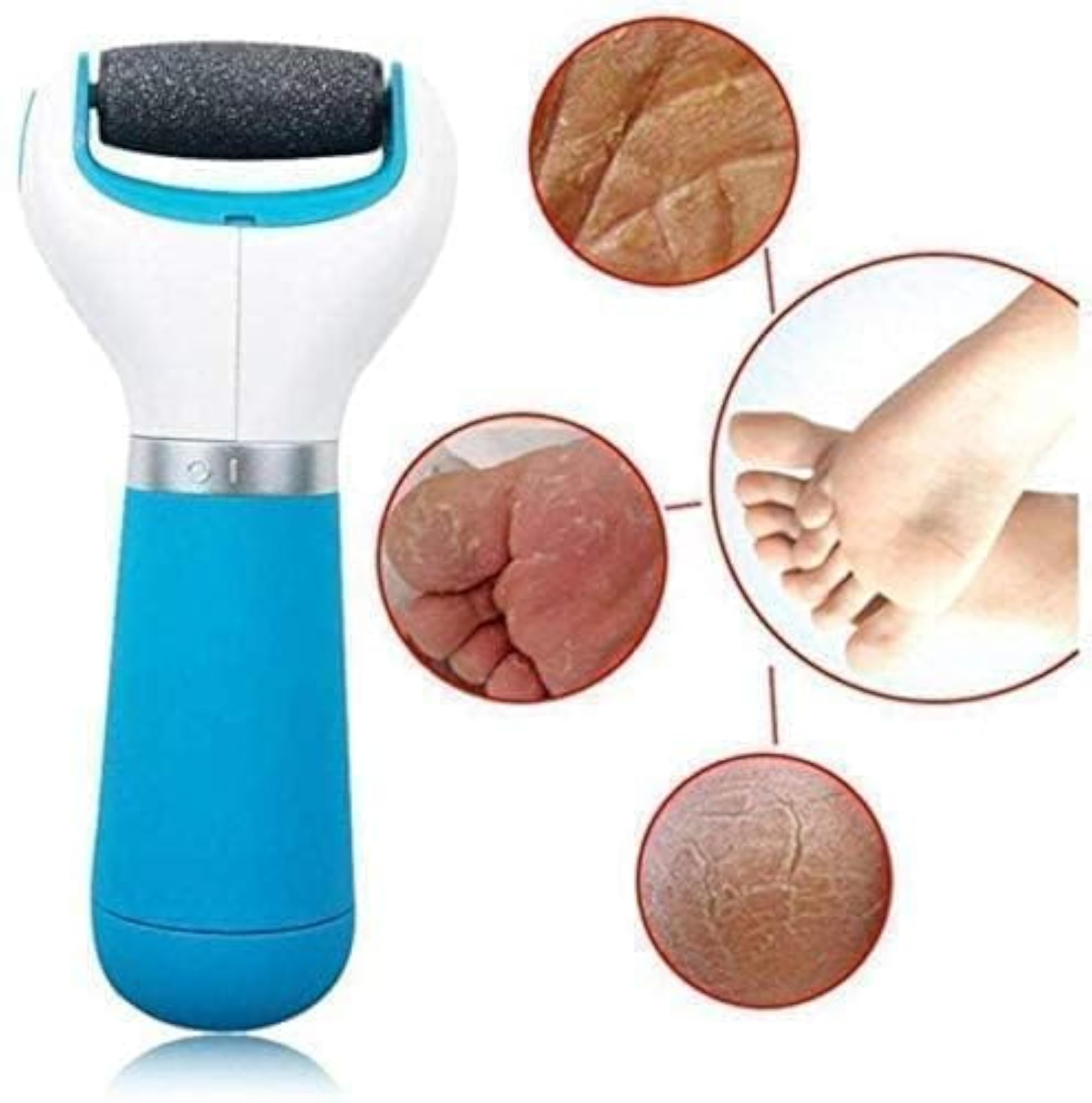 Foot Roller Callus Remover for Hard Skin