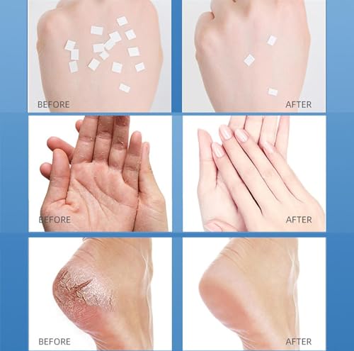 2 Piezas Crema Urea 60% para Pies y Manos - Crema Reparadora Intensiva para Talones Secos y Agrietados, Tratamiento Exfoliante de Durezas y Callos, Hidratante Profunda - imagen 5