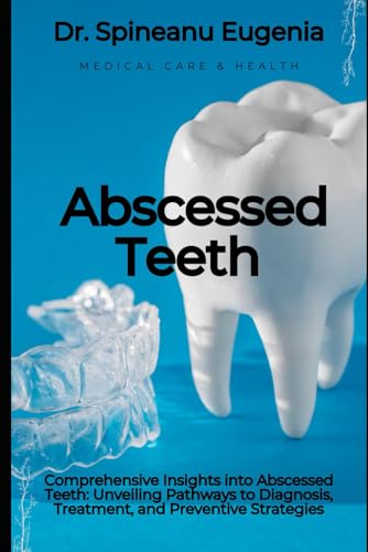 Comprehensive Insights into Abscessed Teeth: Unveiling Pathways to Diagnosis, Treatment, and Preventive Strategies (Medical care and health)