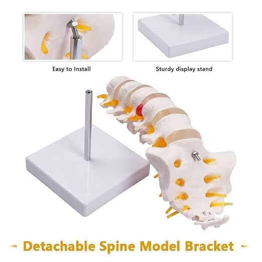 Kay Kay Industries LUMBAR SACRUM SPINE MODEL 1