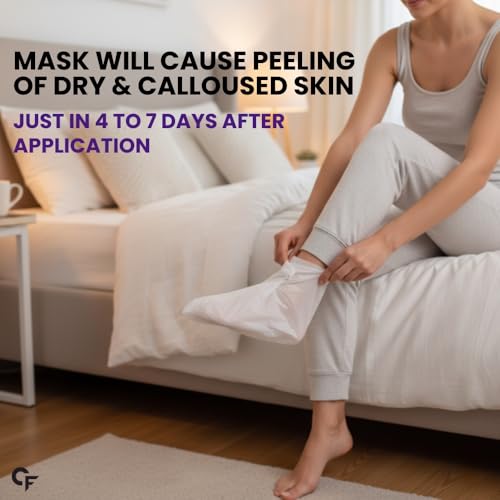 Image of Carbamide Forte Peeling & Exfoliating Foot Peel off Mask for Dry & Calloused Feet | Foot peeling mask With 15% Glycolic Acid, 4% Lactic Acid & Aloe Vera | Helps Remove Dead Skin, Soften Cracked Heels & Calluses | 1 Pair (40g)