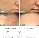 PLANTIFIQUE Clay Mask with Avocado & Superfoods - Korean Face Masks Skincare Products - Dermatologically Tested - Masque Visage Beauté - Gift Idea, 110g / 3.88 fl oz