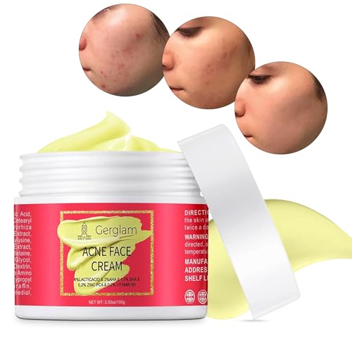 Best Skincare for Acne Prone Skin: Top Products for Clearer Complexion! 21 Acne Face Cream, Salicylic Acid Cystic Acne Treatment For Face, Back But, Acne Spot Treatment for Face and Body Pimple, Acne Treatment Cream, Anti-Acne Skincare Cream for Teens & Adults, 3.53 OZ