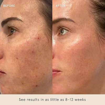 Barefaced Core Four - Original Toning Pads, Liquid Gold, RetinAL, Tinted SPF - the Foundation for Healthy Skin