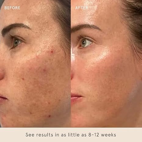 Barefaced Core Four - Original Toning Pads, Liquid Gold, RetinAL, Tinted SPF - the Foundation for Healthy Skin