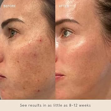Barefaced Core Four - Original Toning Pads, Liquid Gold, RetinAL, Tinted SPF - the Foundation for Healthy Skin