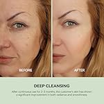 WNP Duo Cleansing Clay Mask with Niacinamide & Hyaluronic Acid – Deep Pore Cleanser for T-Zone & U-Zone, Blackhead Remover, Hydrating & Oil-Control Face Mask, 3.53oz - Image 5