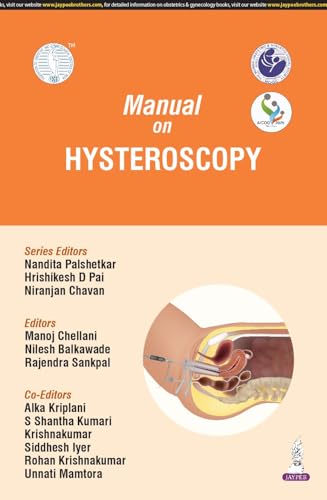 Manual on Hysteroscopy