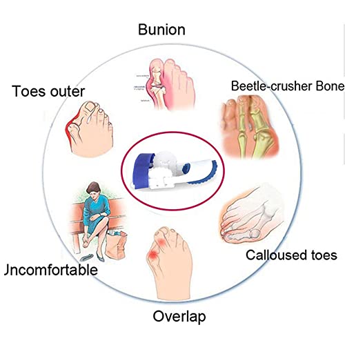 2Peças Separador De Dedo Do Pé Corretor De Hálux Valgo Do Dedo Do Pé Corretor Joanetes Separador De
