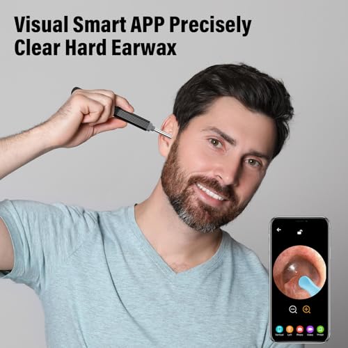 Ohrenschmalz Entferner Otoskop, Morelax 1080P WiFi-Ohrenreiniger, IP67 Wasserdichtes mit 360° Kamera, Ohrendoskop mit 6 LEDs für iPhone, Android, iPad, Erwachsene, Kinder und Haustiere (Schwarz)