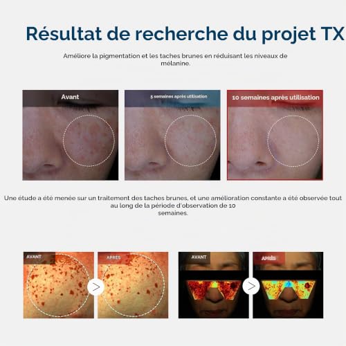 Dr.Melaxin Crème À L'Acide Tranexamique Tx, Soin Coréen Pour Le Teint, 50 Ml (1,69 Fl Oz), Blanche. – vue 6