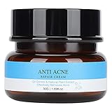 crema antiarrugas para jovenes [ELIMINACIÓN DEL ACNÉ]: La crema tiene un efecto muy bueno para aliviar el acné. La textura ligera reduce la carga sobre la piel, la piel grasa no tiene que preocuparse por el riesgo de acné.