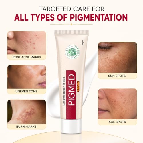 Image of Pigmed Cream for Pigmentation removal, dark spots, acne pimple marks | Ayurvedic depigmentatio(30gm each)(Pack of 3)