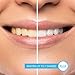 GO SMILE Sonic BLU Hands-Free Professional Teeth Whitening Kit - Hands Free Toothbrush With Gum Massager - Includes Cordless Charger & Foaming Toothpaste & Whitening Tray - No Tooth Sensitivity -Black