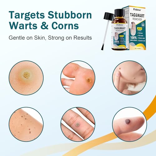 Image of TAG WART Remover, Freeze Off Liquid with 17% Salicylic Acid - Fast-Acting Freeze Off Treatment for Common & Plantar Warts,Flat Wart, Corns - for Feet, Hands & Body (1oz)