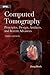Computed Tomography: Principles, Design, Artifacts, and Recent Advances