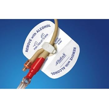 The Benefits of Using Foley Stat Lock in Healthcare