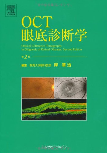 【値引交渉可】(サイン付き)OCT眼底診断学 第2版 Amazon.co.jp: OCT眼底診断学 第2版 : 岸 章治, 岸 章治: 本
