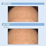 Vitamin A Retinol Pads for Daily Facial Treatment - Niacinamide & Witch Hazel - Facial Exfoliating Disc - Serious Skincare - 60 Count (2Pack) - Image 3