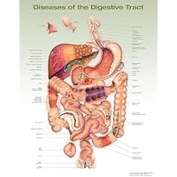 Diseases of the Digestive Tract Anatomical Chart