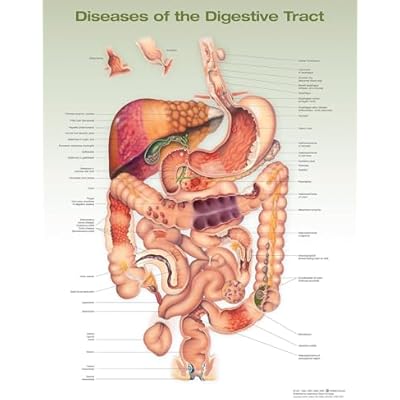 Diseases of the Digestive Tract Anatomical Chart