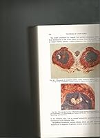 A Textbook of Gynecology B000MJAM1Q Book Cover