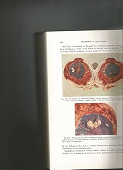 Hardcover A Textbook of Gynecology (Fifth Edition) [Unknown] Book