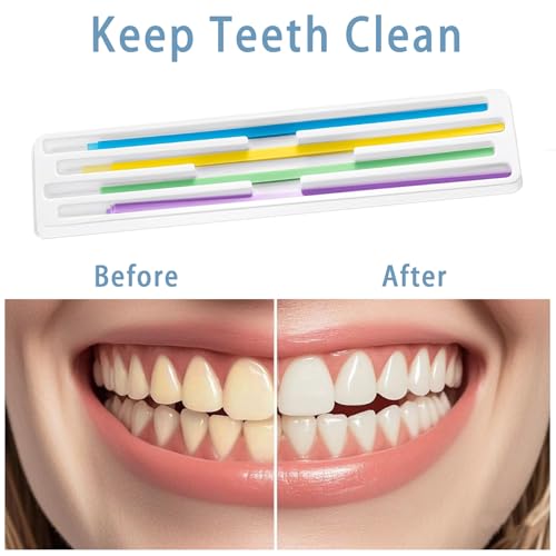 Zahnpolierstreifen, Zahnschleif- und Polierwerkzeug-Set, 80 Teile