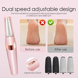ONGNIUU Pedicure Elettrico, Rimuovi Calli Piedi Elettrico, Lima per Piedi e Talloni Elettrica, con 4 Testa di Macinazione, Attrezzo per la Cura dei Piedi Portatile, Elimina Calli e Pelle Morta（Rosa）