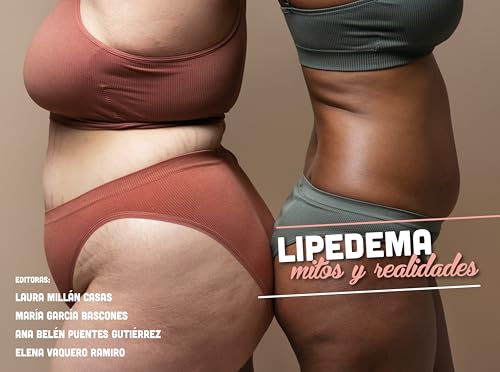 LIPEDEMA: Mitos y Realidades