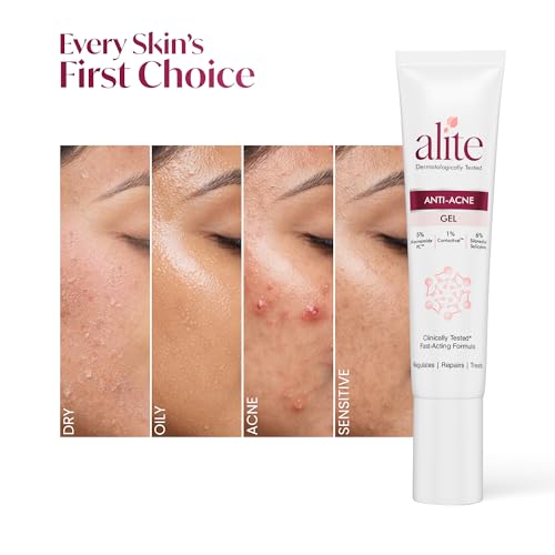 Image of Alite Anti-Acne Gel for Pimple Treatment | Acne Spot Corrector with 5% Niacinamide PC + 6% Silanediol Salicylate | Reduces Active Pimples, Inflammation & Scars | Dermatologically Tested | 15g
