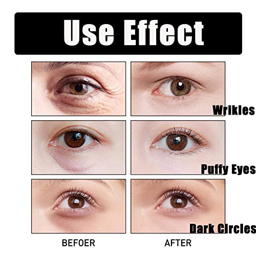 Instantly Brighten Eye Cream,Snake Venom Eye Cream,Anti-wrinkle Eye Cream,Under Eye Cream for Dark Eye Circle,Hydrating Eyelid Cream For Dry Eyelids,Reduce Wrinkles&Fine Lines & Smooth Skin - Image 6