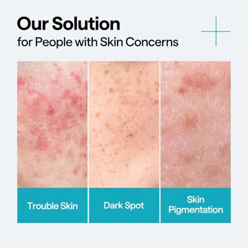 Image of MEDIHEAL Madecassoside Repair Serum, Korean Face Serum with Centella Asiatica & Niacinamide for Blemish Repair, Fades Pigmentation, Dark Spot & Freckles, Soothing Hydrating Skin Barrier Repair Serum (40ml)