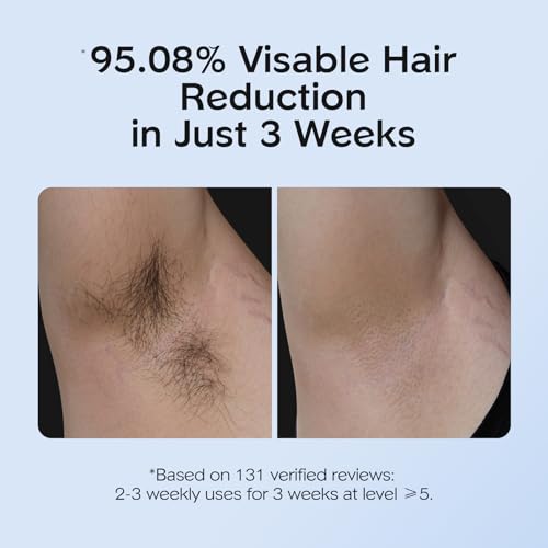 innza ipl hair removal with ice cooling care function for womenlong-lasting results999999 flashes painless ipl hair remover hair removal device for armpits legs arms bikini line