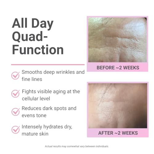 Idunn's Apple Age-Defying Lotion, 1st Ever AKG Anti-Aging Facial Skincare, Alpha Ketoglutarate, Hyaluronic Acid, Antioxidants, Boost Collagen, Reduce Wrinkles, Deep Hydration, Premium 1.7oz Pump