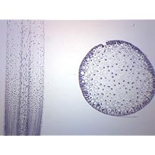 EISCO Ascaris & Onion Mitosis ، شريحة مجهر محضرة - 75 &times; 25 مم - Mitosis النبات والحيوان ، الفحص المجهري التمهيدي